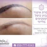 הסרת קעקועים ואיפור קבוע כושל בלייזר סטלה